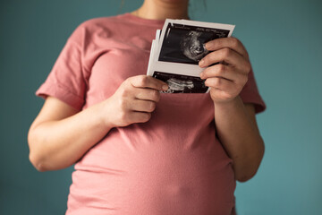 Pregnant woman holding a sonogram of her unborn baby.