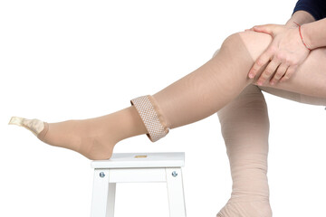 Compression garments for the treatment of lipoedema and lymphoedema.Lymphedema management: Wrapping leg using multilayer bandages to control Lymphedema. Part of complete decongestive therapy (cdt