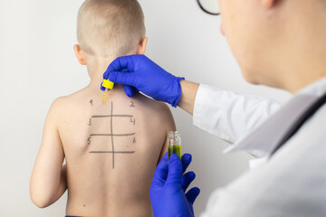 An allergist in the laboratory conducts an allergy prick-test. Skin test for household, food,...