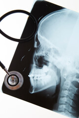 Skull x-ray and stethoscope