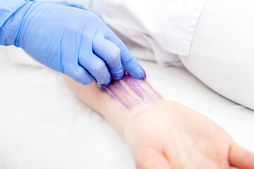 The beautician makes the girl epilation on her arm. Shugaring. Epilation with sugar paste. Cosmetology cabinet. close-up