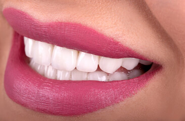 Perfect Close Up Sensual sexy Seductive Plump Lips woman smile . White beautiful Teeth bleaching ceramic crowns whitening young lady smiling. Dental zircon implants restoration surgery Fashion concept