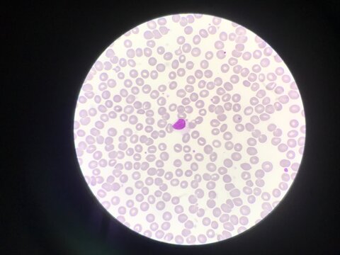 White blood cell lymphocyte on red blood cells background.