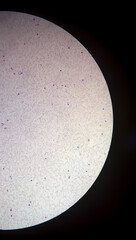 Microscopic view of hematology slide. RBC. WBC. closeup. Stained slide. Smear. Platelet, blood film