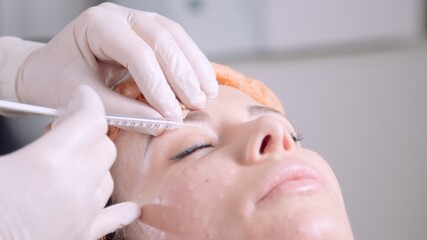 Doctor's hands makes injections into female eyebrow. Mesotherapy treatment in the beauty salon. Beautician in gloves put injections in the face. Cosmetologist making treatment procedure to the patient