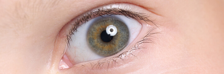 Wide open child's eye with an eyebrow and moles on skin. Visual examination in children