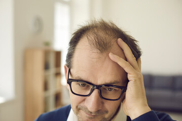 Middle aged man in glasses touches bald spots on his head that need treatment. Close up of the top of the head. Concept of mature people worrying about hair loss and scalp problems