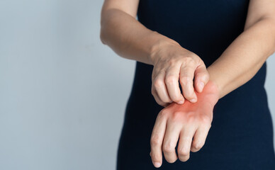Itching of skin diseases in women using the hand-scratching. Red around the Itching area. Concept...