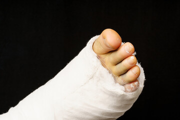 A leg in a plaster cast with a black background.