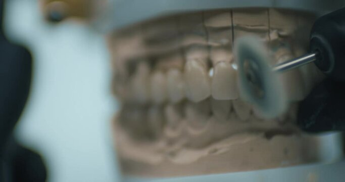A dental technician is holding a model of artificial upper and lower jaw, and polishing it with an electrical cutter.