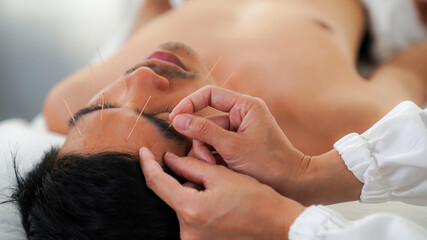 Close-up of a man's face treated by a Chinese alternative medicine, acupuncture facial therapy in a spa. Acupuncture needle.