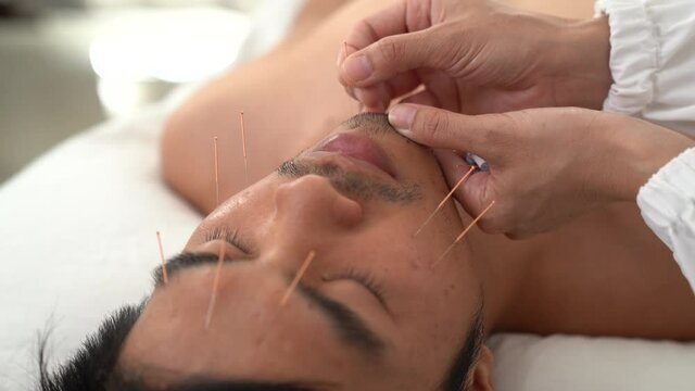 Close-up of a man's face treated by a Chinese alternative medicine, acupuncture facial therapy in a spa. Acupuncture needle.