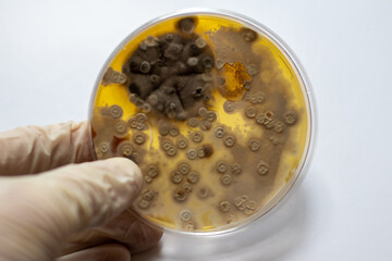 hand holding a petri dish with black and yellow bacteria and yeast, close up shot