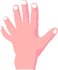 Obraz premium Vector Illustration of Hexadactyly, Six Fingered