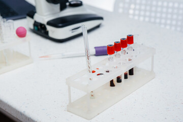 Medical test tubes with blood tests close-up in the laboratory