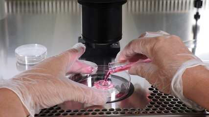 Close-up of the IVF procedure. An embryologist wearing protective gloves drips the medium from a...
