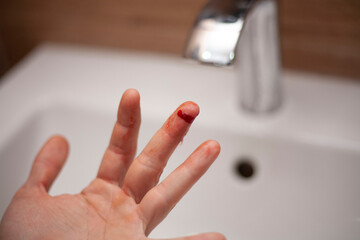 The man cut his finger. A cut. Blood flows from the finger