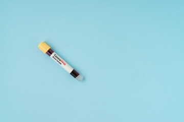 Blood sample vacuum tube on blue background with a copy space. Corona virus concept. Flat lay.