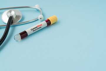 Stethoscope and blood sample vacuum tube on blue background. Corona virus concept with a copy space.