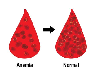 Anemia and normal ammount of red blood cells