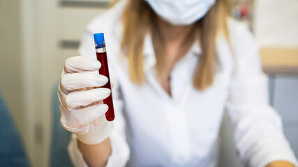 Female scientist holding test tube with blood sample. The concept of analyzes and diagnostics of viruses and diseases. Focus on the test tube