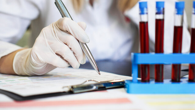 Woman working with blood samples in laboratory, closeup. The doctor writes the test results into a form