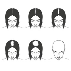 Stages of female hair loss, treatment and hair care