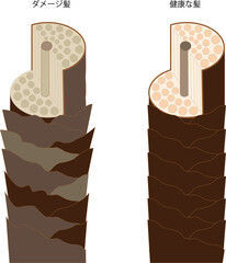 キューティクル