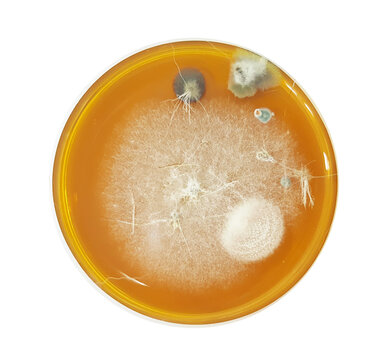 A dermatophyte test medium (DTM) culture in Petri dish using for growth media to isolate and cultivate fungal testing from clinical samples, investigation of ring worm (skin disease).