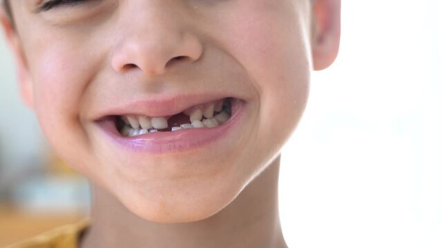 enfant montrant la dent qu'il a perdu r&eacute;cemment et montrant un beau sourire sans la dent manquante