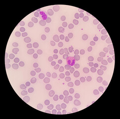 Under microscopic of elephant blood film showed red blood cell, platelet, heterophil, lymphocyte, monocyte and eosinophil. Blood morphology of Elephant.