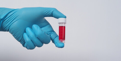 Blood tube. Covid 19 Test. doctor hand holding a blood sample tube for analysis in the lab background. Technician in medical gloves holding blood tube test for research vaccine protect virus infected.