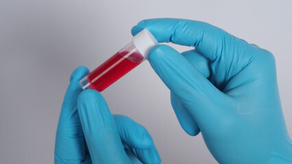 Blood tube. Covid 19 Test. doctor hand holding a blood sample tube for analysis in the lab background. Technician in medical gloves holding blood tube test for research vaccine protect virus infected.