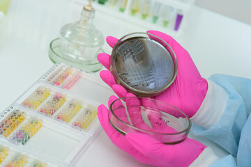 Fototapeta na wymiar Petri dishes in the laboratory