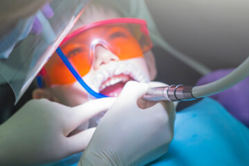 Kids dentistry. Children's dentist examination baby teeth. Emotions of a child in a dental chair. Little boy in protective orange glasses and cofferdam. Process treatment caries.