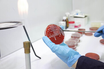 bacterial growth on culture media in petri dish 