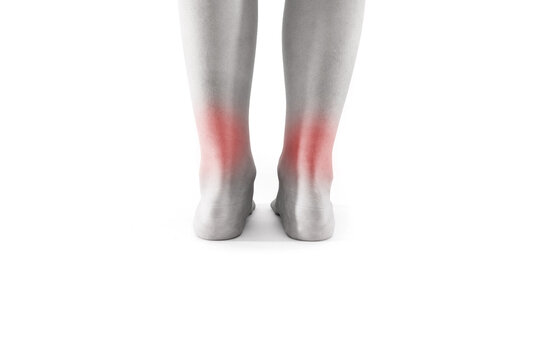 Pain in the legs. Sprain. Black and white image. Legs on a white background.