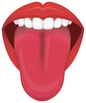 Tongue’s health sign vector illustration ( Strawberry Tongue )
