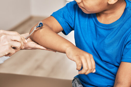 Doctor uses a neurological Wartenberg needle wheel for a child's hand reflexes exam. Neurology, close-up