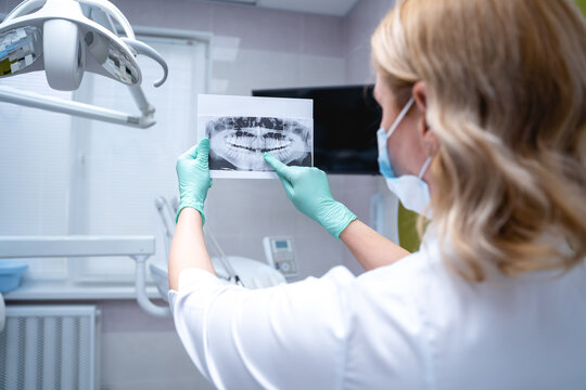 A surgeon in a dental clinic examines a picture of the jaw