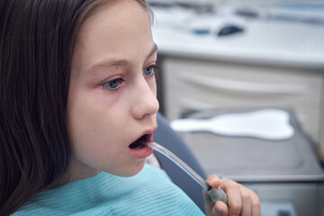 A teenage girl sits in a chair at the dentist's doctor and holds a saliva ejector in her mouth. - obrazy, fototapety, plakaty