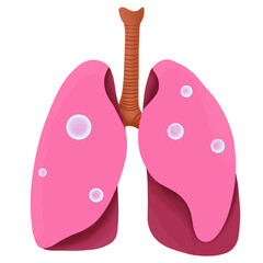 Hand drawn vector flat illustration of human lungs with Ground-glass opacity GGO on white