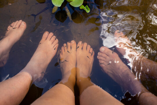 Ichthyotherapy - Ictioterapia en laguna el Oconal de Villa Rica