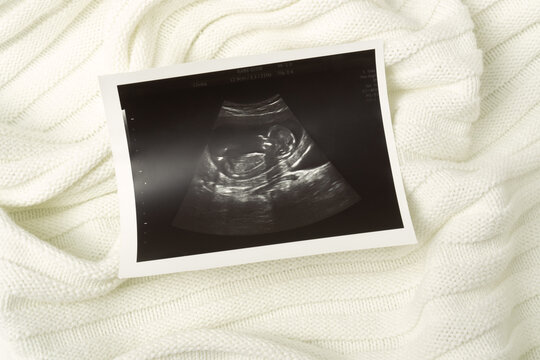 Image of baby during ultrasound examination on white soft fabric background.