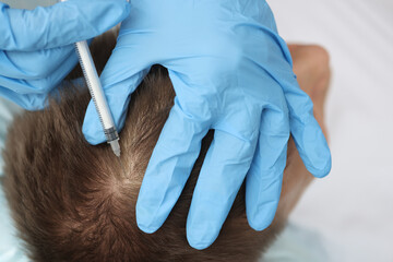 Doctor trichologist makes an injection into the scalp of man
