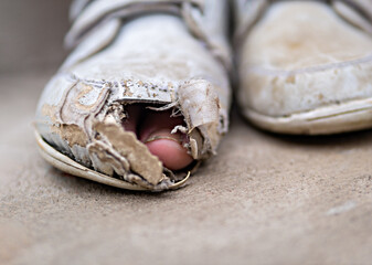 Foot in a damaged sport shoes of a poor child