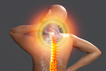 Neck pain, illustration