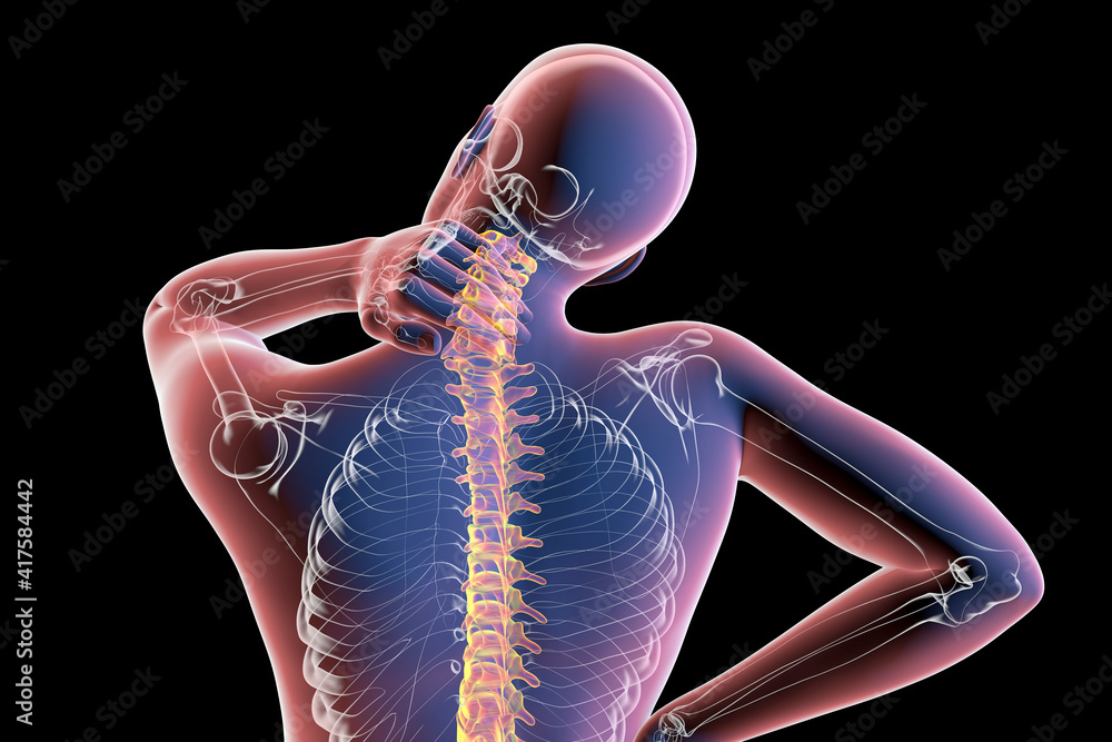 Sticker Neck pain, illustration