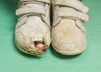 Toe looks out of a totally worn and broken sports shoe