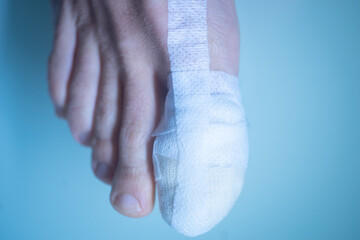 Foot big toe bandage injury